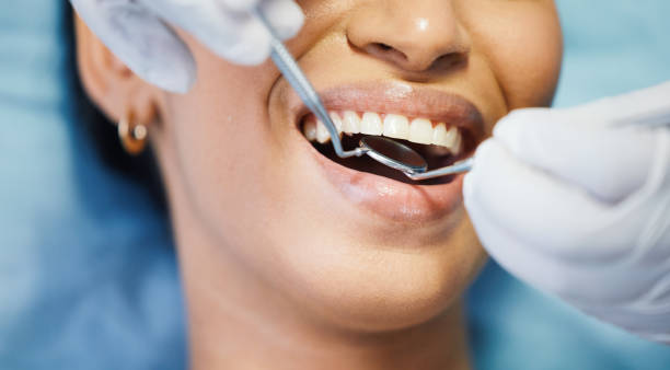 Best Emergency Treatment for Dental Infections or Abscesses in Rochester Hills, MI